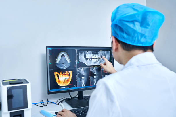 Best Emergency Wisdom Teeth Removal in Horn Lake, MS